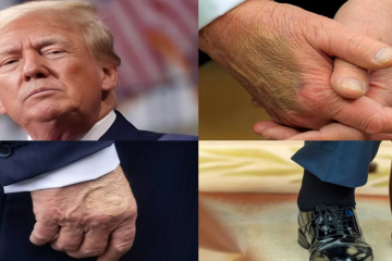 डोनाल्ड ट्रंप की वायरल तस्वीरों से उठा स्वास्थ्य पर सवाल: वाइट हाउस ने मेडिकल रिपोर्ट जारी कर दी सफाई